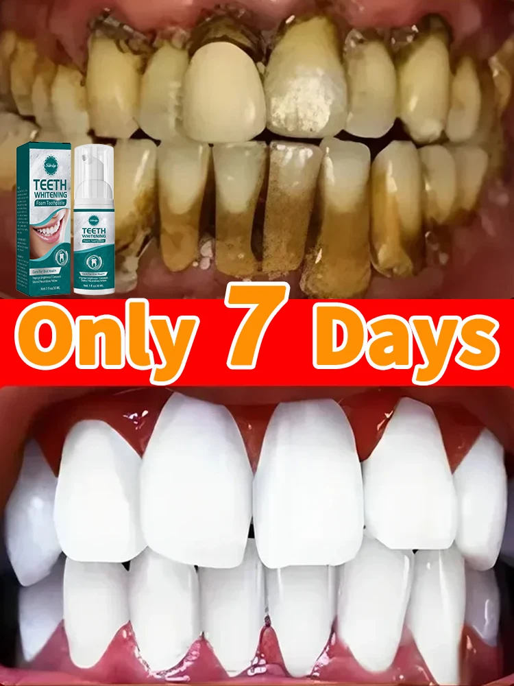 

Tartar removers dissolve tartar and remove stains bad breath remover