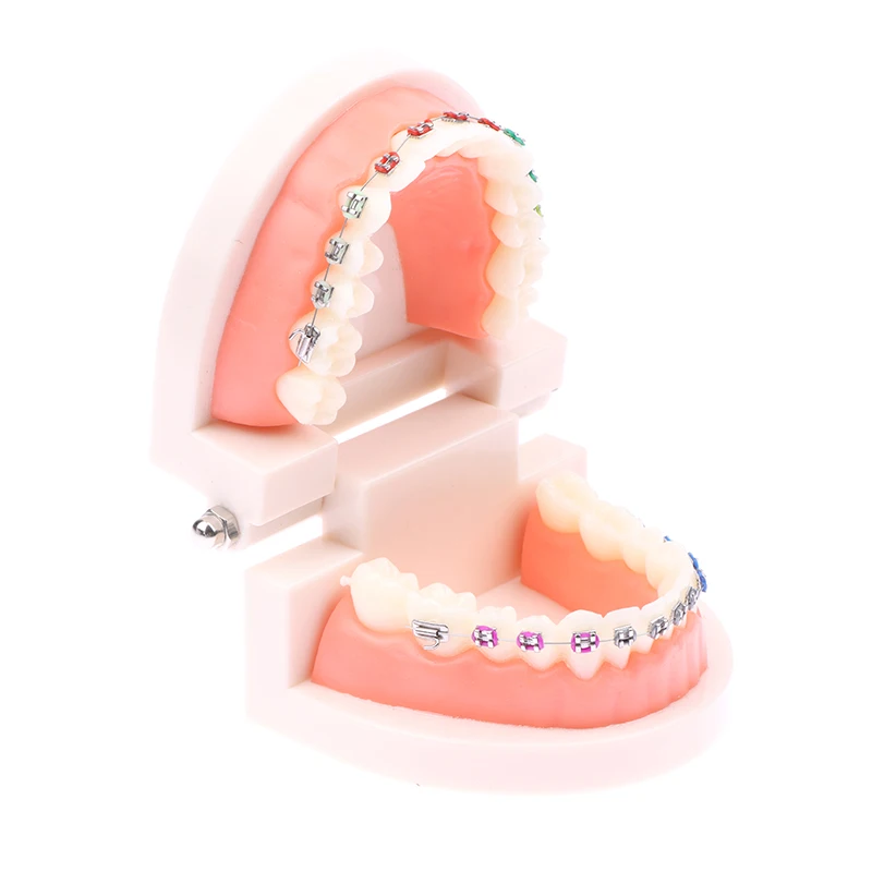 

Dental Orthodontic Model Half Metal Half Ceramic Braces Crowding Teeth Treatment Standard Teaching Model Dental Teeth Model