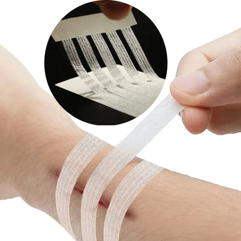 10 bag Wound Skin Closures Strip Medical Surgical Tape No Need To Suture Skin Sterile Postpartum Wound Repair