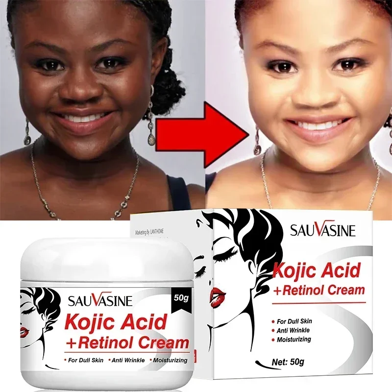 Kojic Acid Cream Remove Pigment Melanin Whitening Remove Dark Spots Cream Nourishing & Resurfacing Fade Skin Care Face Cream