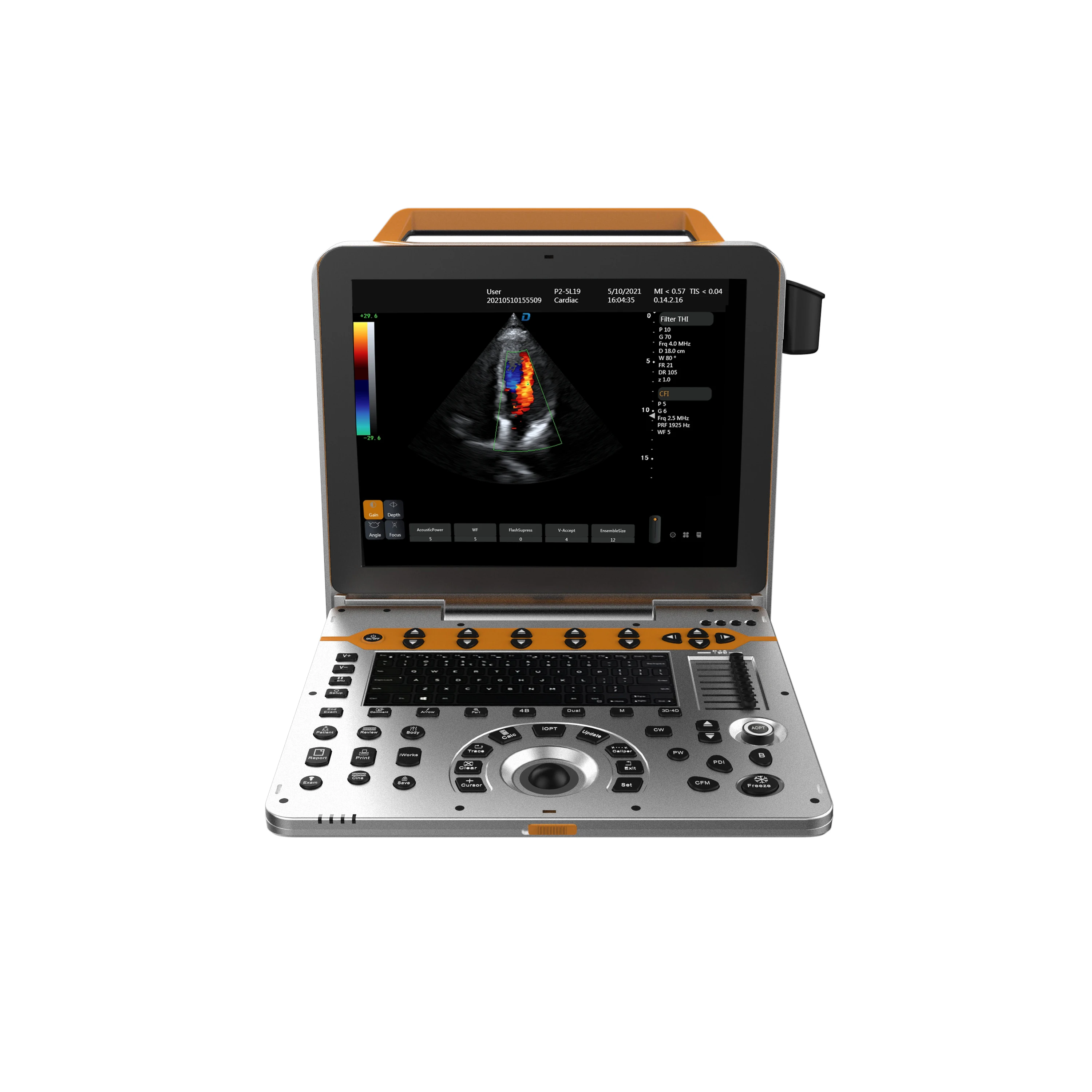 30 Adjustable 15 Inch LED Screen New Advanced Color Doppler Portable 5d Sonoscape E1 Ultrasound Machine Price for Human