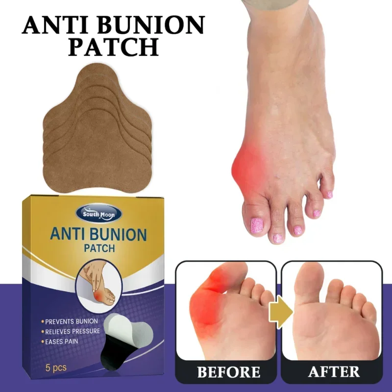 

5pcs Anti-bunion patch foot care relieves swelling pain hallux valgus Corrector Orthotics Feet Bone Thumb Adjuster Treat Paste