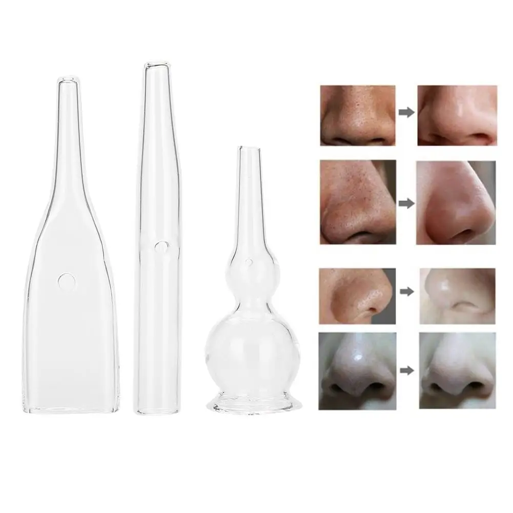 3PC Blackhead Removal Glass Pipes Set - Facial Pore Cleaner Vacuum Suction Skin Care Tool for Beautiful Skin