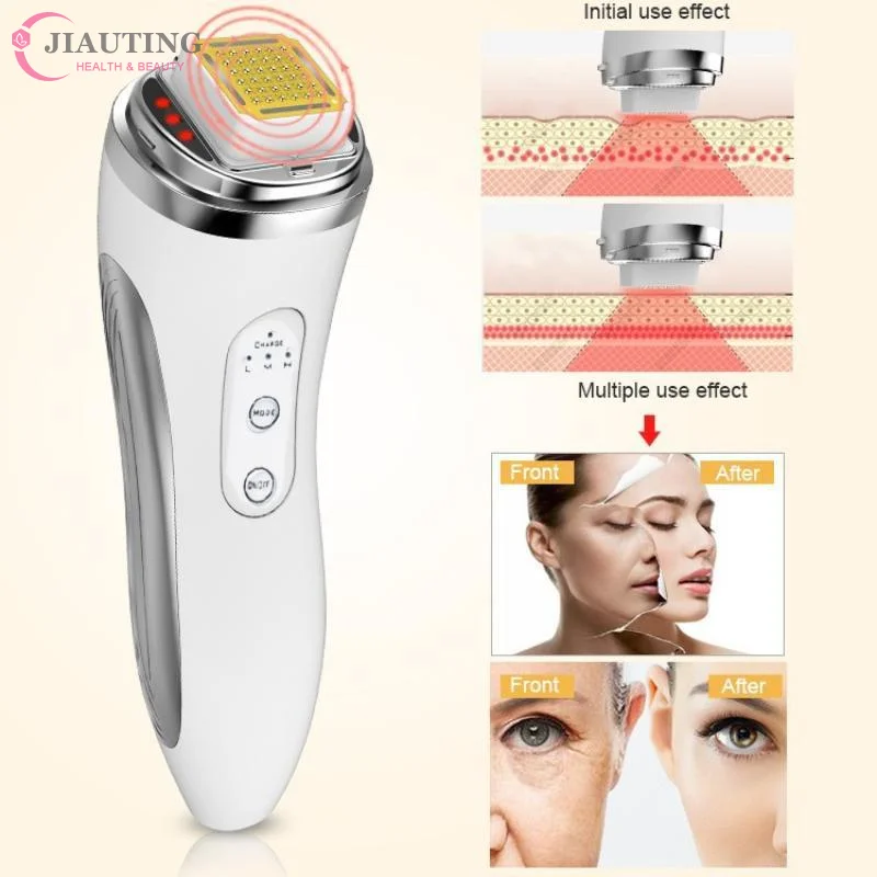 جهاز رفع الوجه بالترددات الراد - مراجعة Radio Frequency Face Lift Machine وسعره