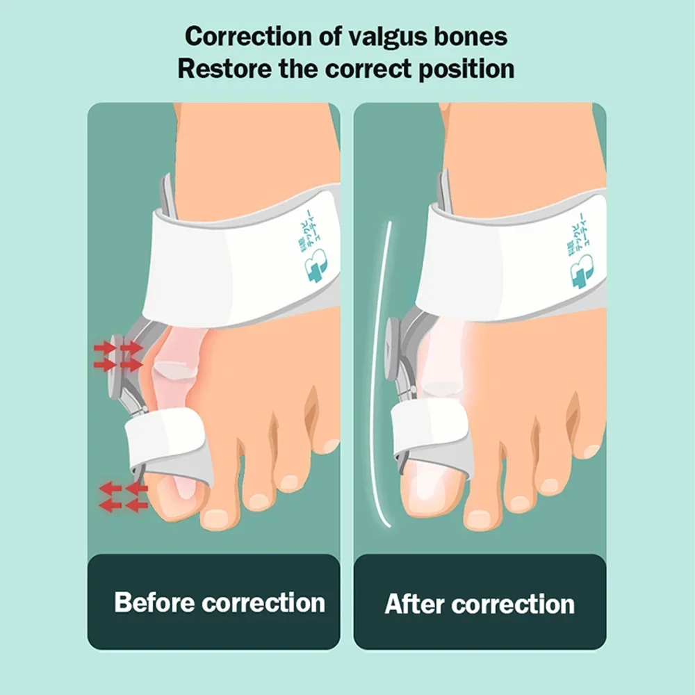 1pc Bunion Splint Big Toe Straightener Hallux Valgus Correction Orthotics Foot Bone Thumb Adjuster Correction Pedicure brace