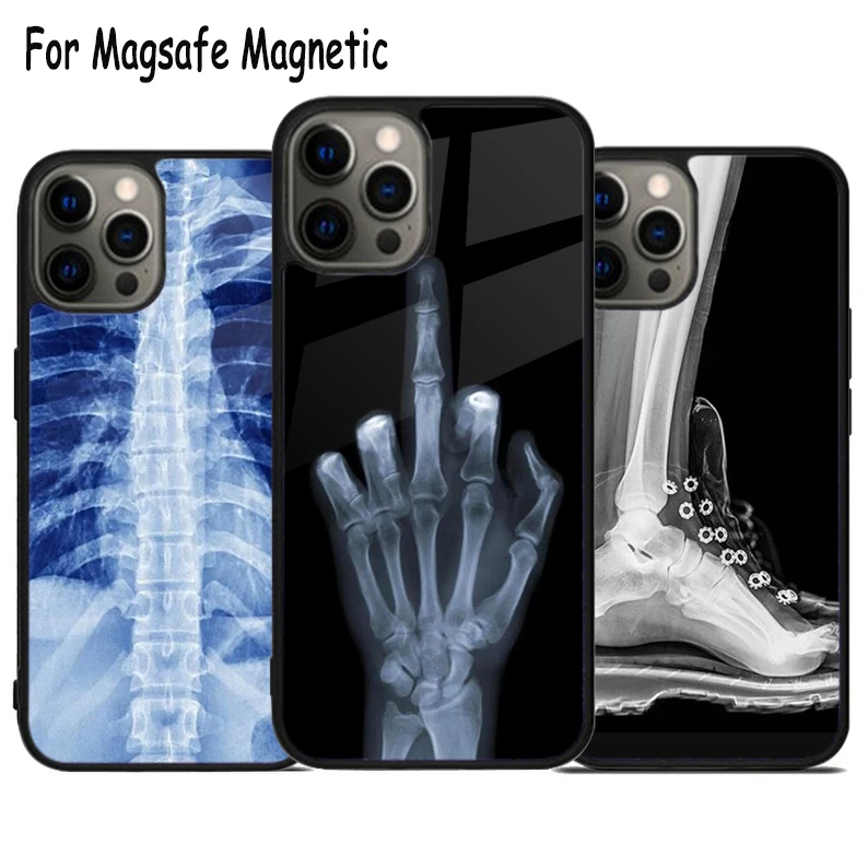 X-Ray Human Anatomy Wireless Charge Magsafe Phone Case For iPhone 15 16 14 13 11 12 Pro Max Plus Magnetic Bumper Cover