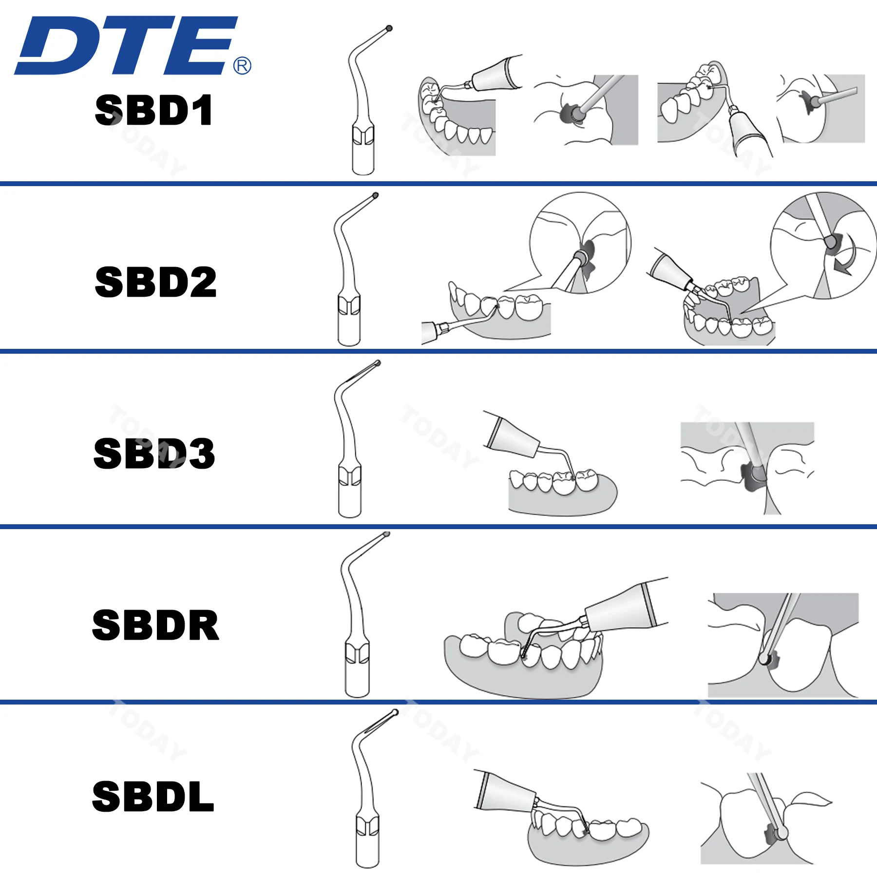 Woodpecker Dental Ultrasonic Scaler Dicas, SBD Cavidade Preparação, NSK SATELEC Handpiece, DTE