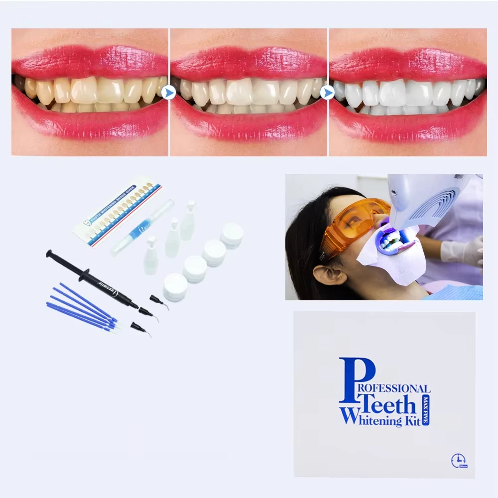 

Luxsmile комплект для отбеливания зубов, набор гелей для отбеливания зубов, профессиональная лампа для отбеливания зубов