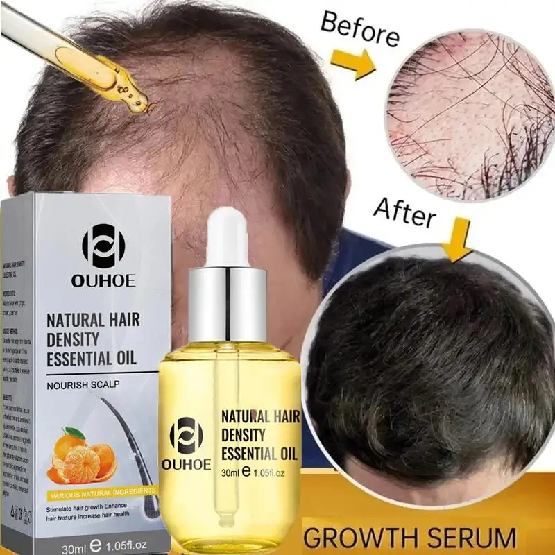 

Ginger Hair Growth Essential Oil Anti Hair Loss Scalp Treatment Regrowth Thicken Hair Care Serum For Men Women Hair Care