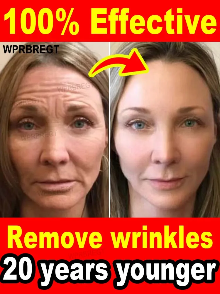 20 years younger, 100% wrinkles disappear