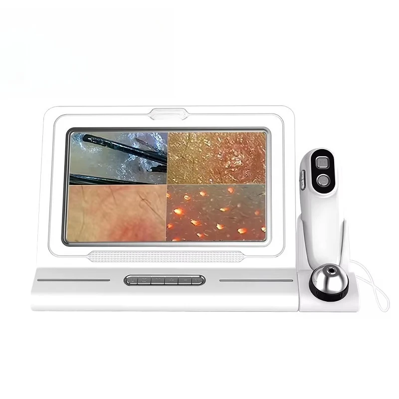 HD Hair Follicles Scanner Scalp Diagnosis Detector Hair A/nalyzer Scalp Analysis D/evice Home Use B/eauty Salon