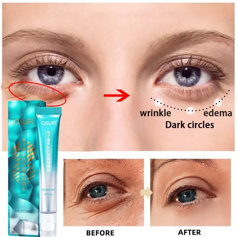 Crème anti-déformable pour les yeux, élimine les poches, les cernes, raffermissante, lisse, hydratante, essence de massage, 7 jours