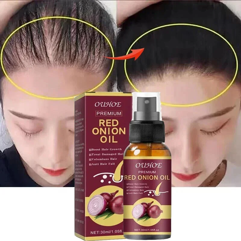 Powerful Hair Growth Spray Anti Hair Loss Serum Products Fast Grow Repair Nourish Roots Regrowth Thicken Hair Care For Men Women