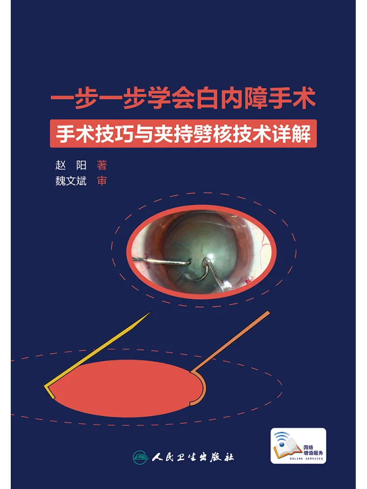 

Книга — Winshare: Учимся проводить операцию по удалению катаракты шаг за шагом