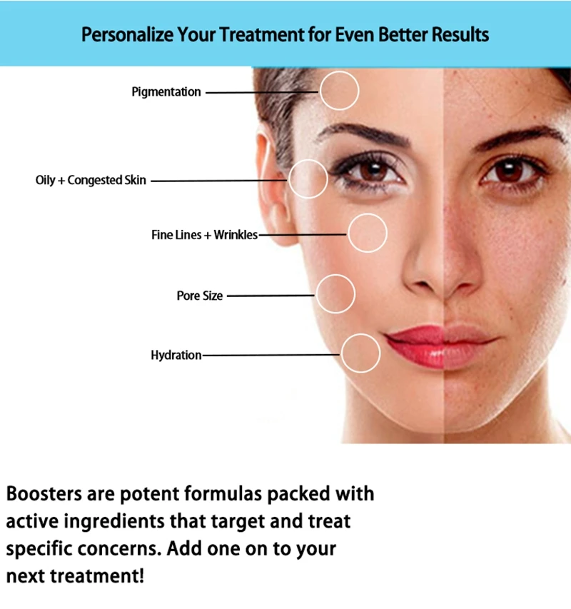 4-in-1 เปิดตัวเครื่องทําความสะอาดผิวหน้าแบบมืออาชีพ Hydra Skin Deep และ Anti-aging พร้อมอุปกรณ์ขัดถู Microcrystalline