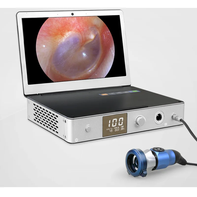 cheap Medical portable endoscope camera for fiber endoscope for MAC OS with light source