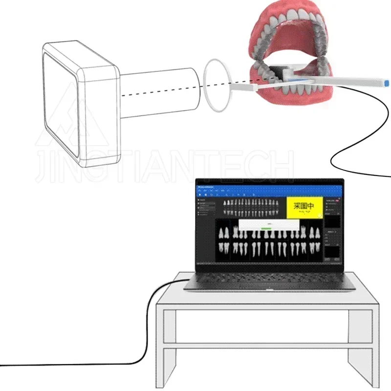 JINGT Dental Portable X-Ray Rayer Oral Sensor Suite In Digital Imaging System Handheld Filmmaker X-Ray Machine Intraoral Set