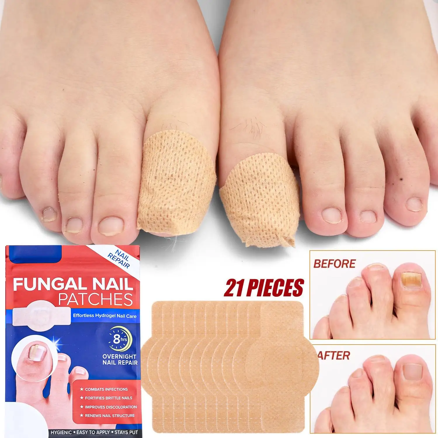 21 Adesivos para Reparo de Unhas, Adesivo para Fungos nas Unhas dos Pés, Ferramentas de Cuidado Adesivas, Adesivo Corretor de Unha Encravada, Adesivo Descartável para Paroníquia