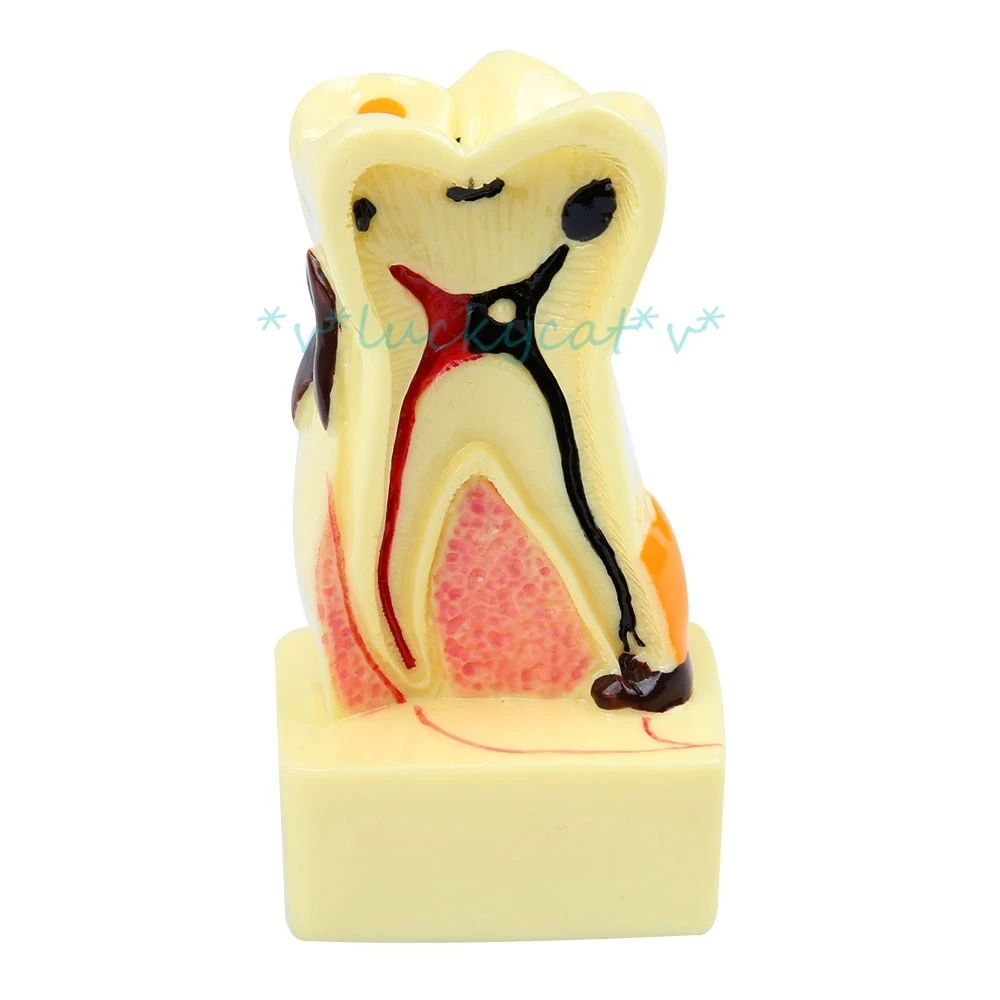 

1pcs new Oral dental model 4 times transparent molar profile model with nerve pattern details For Dental Lab item model tool