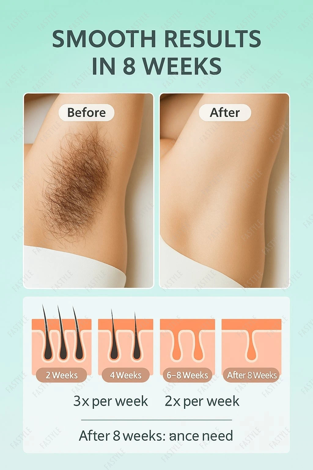 

990000 вспышек, система удаления волос IPL, безболезненный постоянный эпилятор для тела, бикини, лица, нежный для кожи, безопасный для чувствительных зон