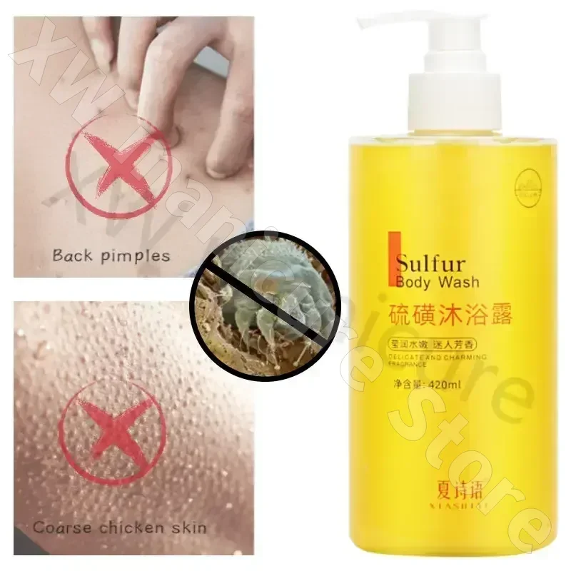 

Sulfur Body Soap Body Deep Cleansing and Refreshing Moisturizing Oil Control Mite Removing Liquid Soap 400ml