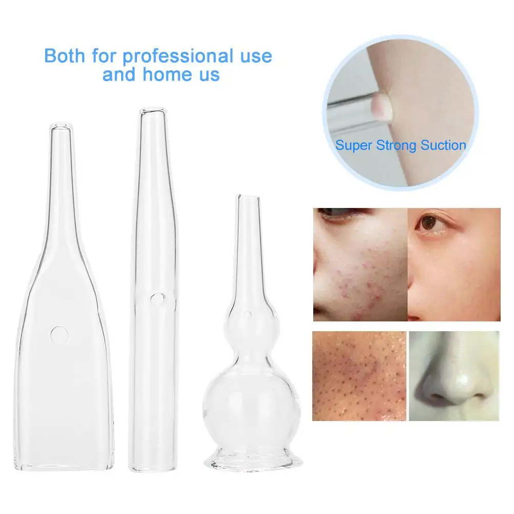 3PC Blackhead Removal Glass Pipes Set - Facial Pore Cleaner Vacuum Suction Skin Care Tool for Beautiful Skin