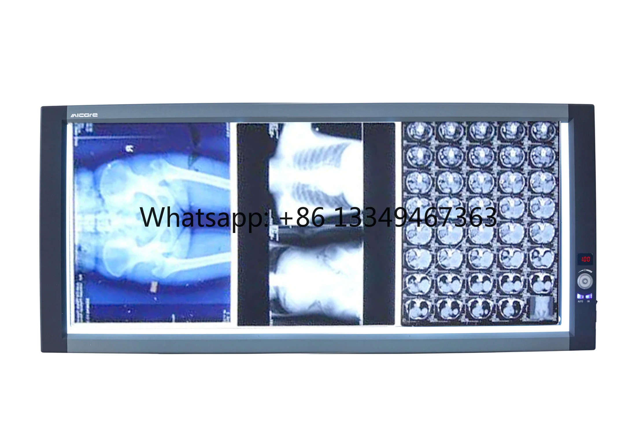 

Hot Selling Medical X-ray Film Viewer Led Source with High Contrast Great Uniformity Long Life Span Fast delivery
