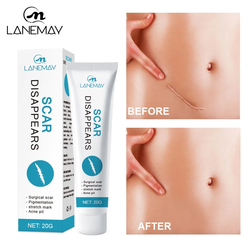 All-in-One Scar Repair Cream | Targets Surgical, Burn, Stretch Mark & Acne Scars, Plant Extract Gentle Formula, 20g