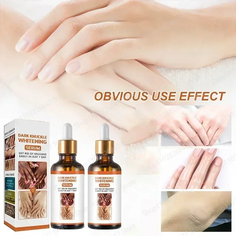 knuckles whitening Essence For Lip Areolas Private Parts Tender Remove Intimate Melanin Skin Care Whitening Dark Spot Body Serum