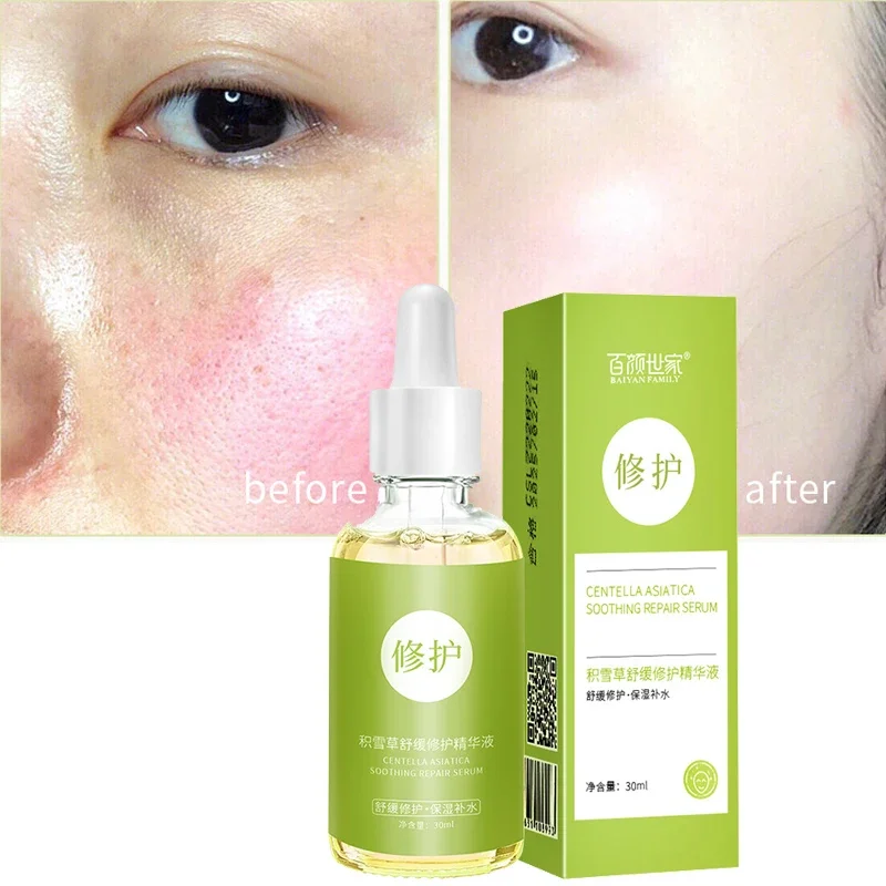 Centella asiatica original solution to remove red blood silk, repair cutin sensitive muscle hormone, face repair essence 1pcs