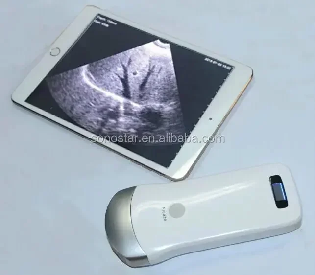 

UProbe-2 wireless probe iPad ultrasonic scanner for sale