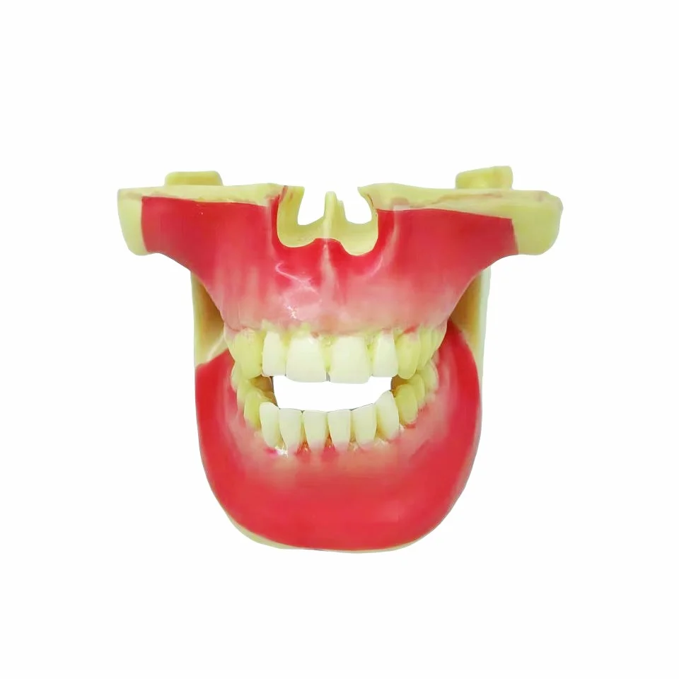 Human Jaw Anatomical Model Life Size Upper Lower Jaw Teeth Replica for Medical Education Dental Training Demonstrations