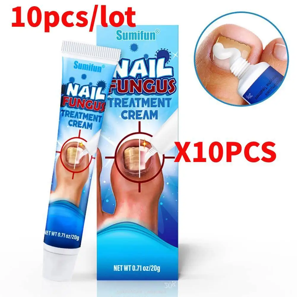 10PCS ที่มีประสิทธิภาพเล็บครีมเชื้อราเล็บกําจัด Onychomycosis ครีม Paronychia นุ่มเล็บเท้าซ่อม