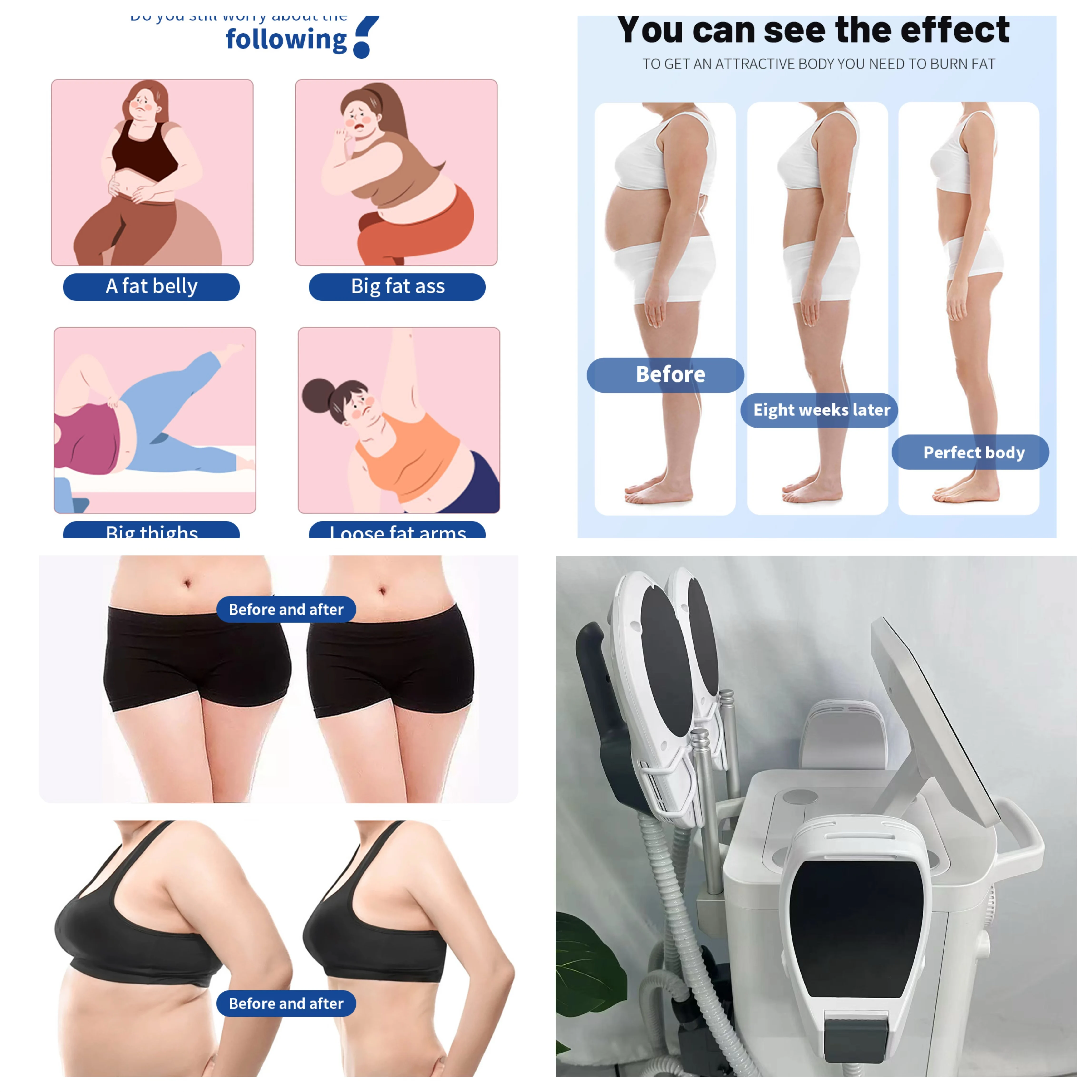 

Myoslim 15 T 6500W Neo RF EMS Black Gold: Аппарат для коррекции фигуры и стимуляции мышц с технологией сжигания жира