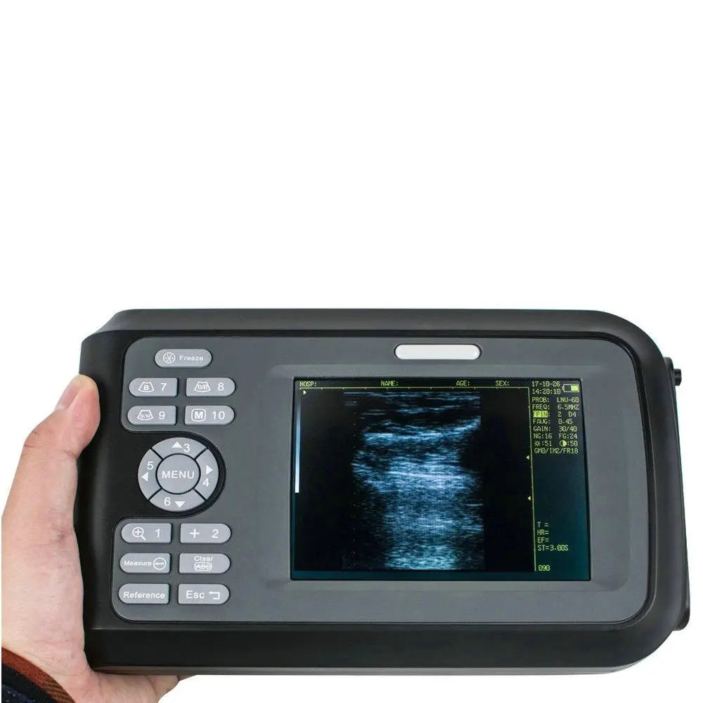 Large farm animals handscan V8 portable veterinary ultrasound