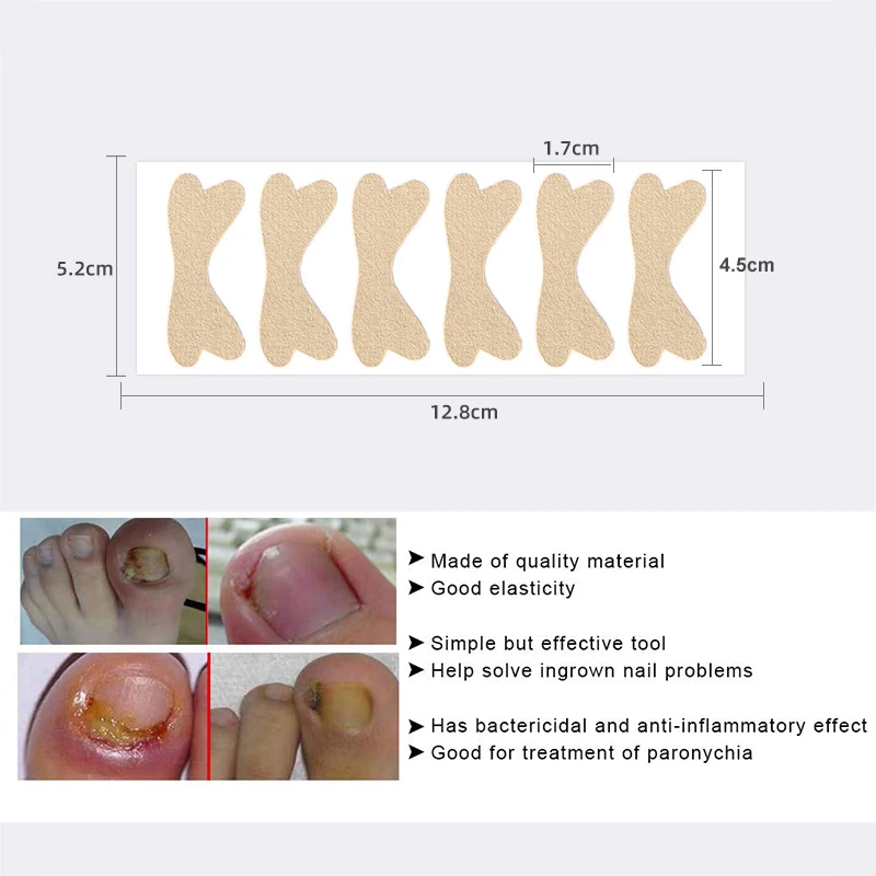 Pexmen 6/12/30 pces encravado toeuil correção adesivo esparadrapo toe tratamento do prego corrector ferramenta de cuidados com os pés