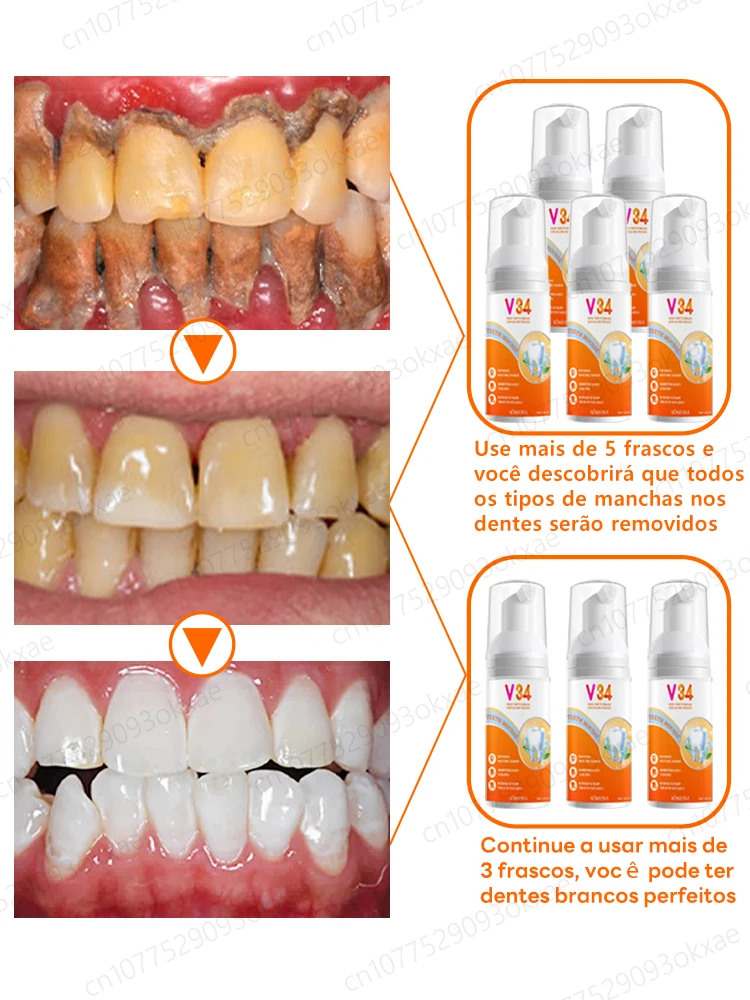 Dentes branqueamento creme dental, respiração clara e remover manchas