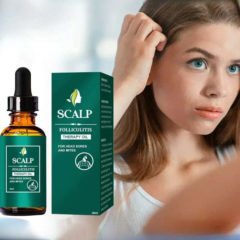 Óleo Essencial de Crescimento Rápido para Homens e Mulheres, Produtos de Regrota do Cabelo Gengibre, Soro, Previne o Desbaste, Reparação Seca, Frizzy, Refrescante