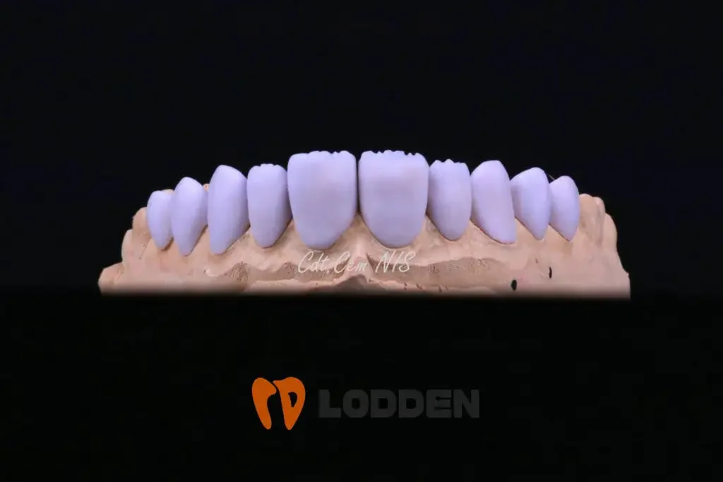 4 szt. CAD CAM Dental litowa szklana blok ceramiczny B40 Li-narzemianowa szklana ceramika bloki 40*15*15mm stomatologiczny blok ceramiczny