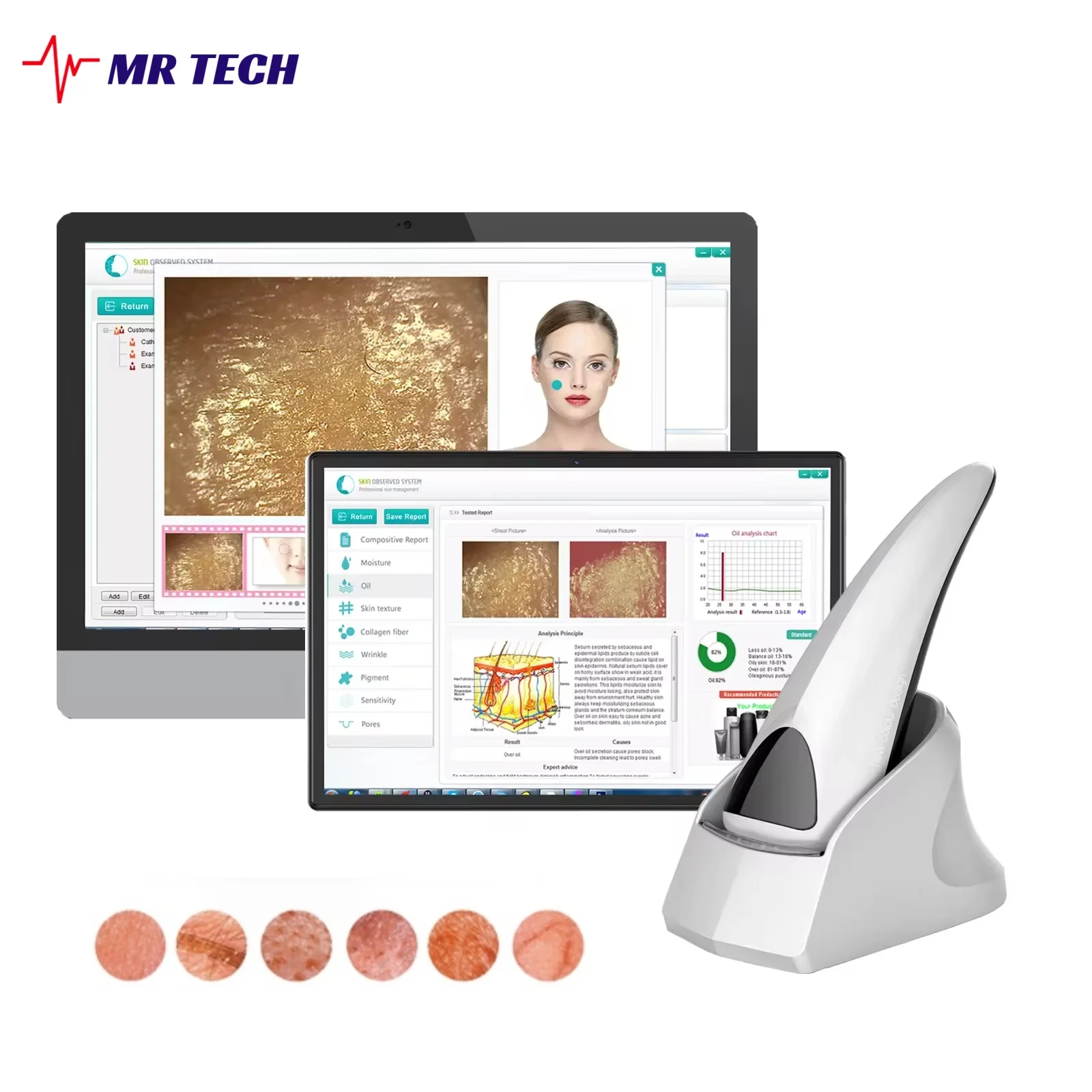 

Multi Languages Professional Intelligent Skin Diagnosis Facial Analyzer 3D Skin Microscope Detector For Windows System