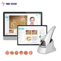 Analizador Facial de diagnóstico de piel inteligente profesional en varios idiomas, Detector de microscopio de piel 3D para sistema Windows
