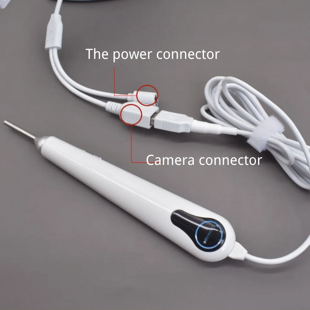 3.2mm Thin Lens Digital Otoscope with 1080P HD 10.1 Inches Big Screen Ear Scope ENT Endoscope Ear Cleaner Tools 3500mAh Battery