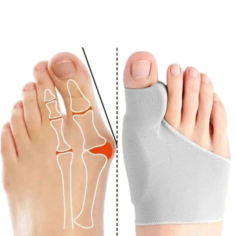 للاسترخاء عند أصابع القدم الكبيرة، مصحح الورم المطاطي، لدعم فاصل أصابع القدم من Hallux Valgus