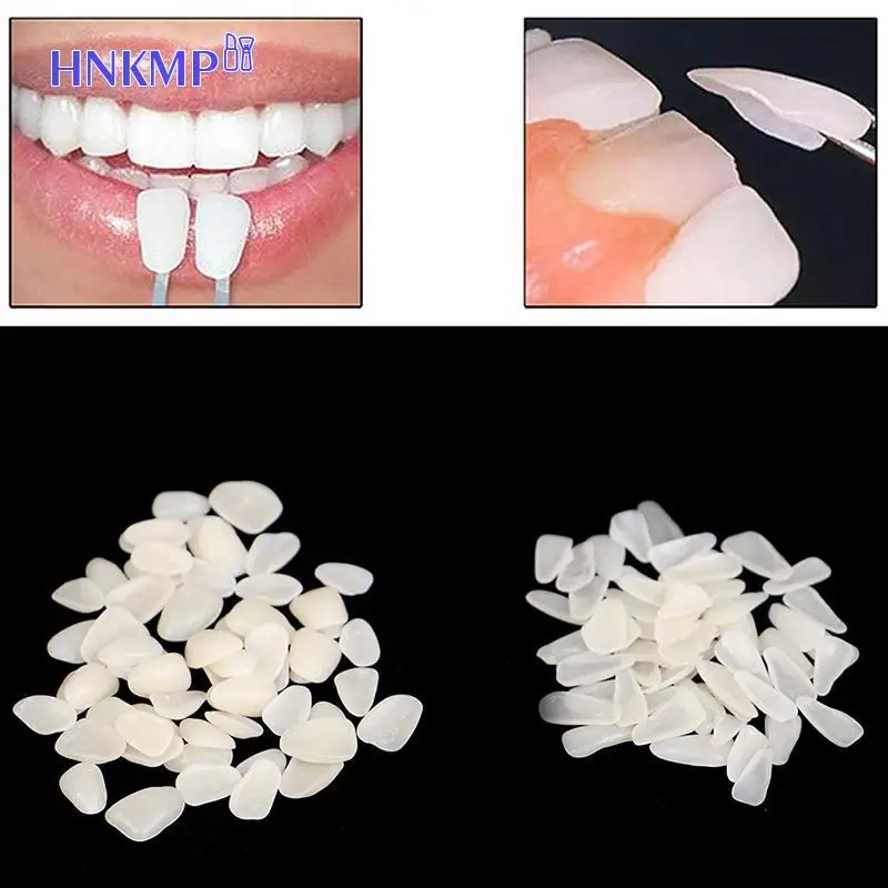 Couronne temporaire antérieure ultra mince, placage de dents en porcelaine blanchissante, dents en résine pour voiture dentaire, 60 pièces