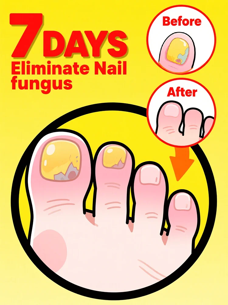 

Quickly eliminate fungus and restore healthy nails