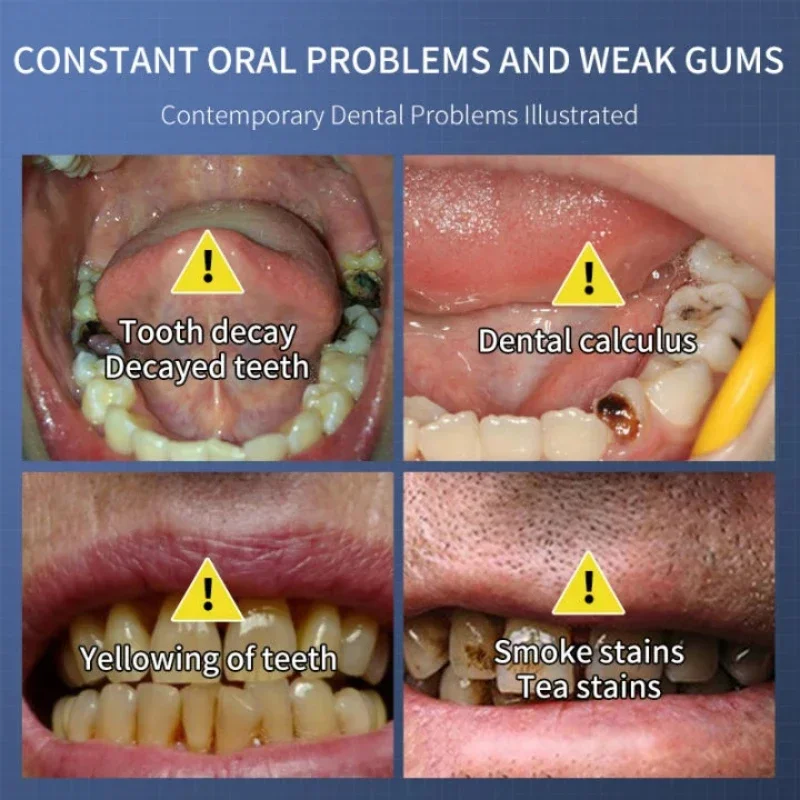 Dentifrice blanchissant pour les dents, dissolvant de plaque SAF, élimination des odeurs de la bouche, mauvaise haleine, propre haleine fraîche,