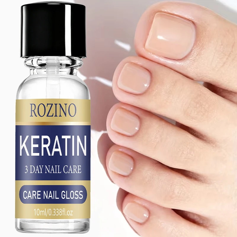 Rozino Keratin Nail Care Solution Is Suitable for Hand and Foot Nails, for Daily Care in Autumn and Winter. the Moisturizing Texture Hydrates the Nail Surface, and Keratin Cares for the Nail Edges. It Comes with a Brush Head, Making It Compact and Portable.
