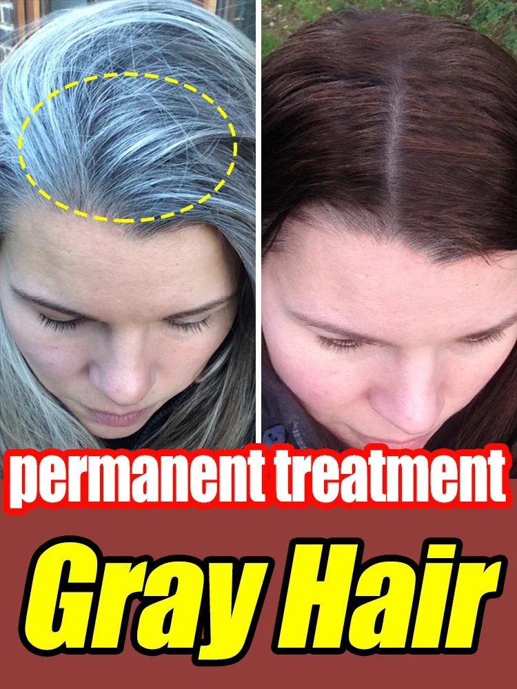 Grey hair restoration, restoring hair colour