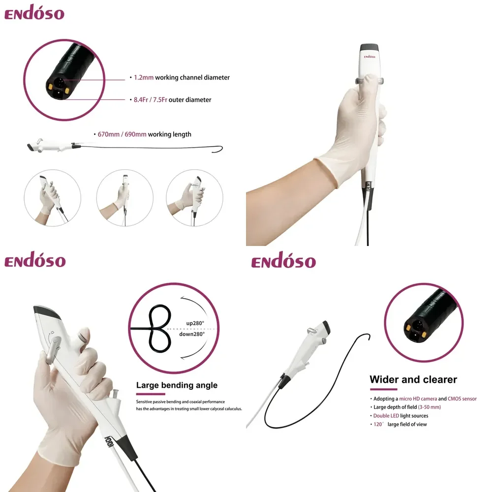 CE Approved HD Medical 7.5fr Single Use Digital Flexible Ureteroscope for Urology
