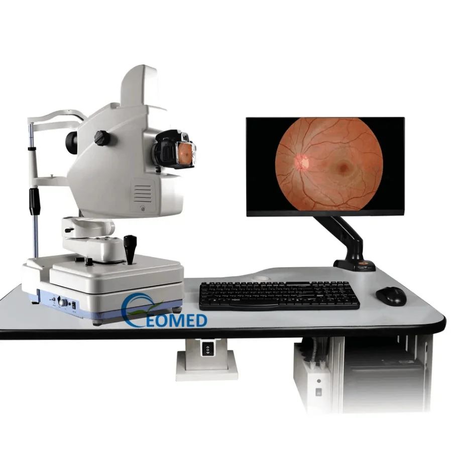 High Efficient Professional EOMED Ophthalmic Equipment Non-Mydriatic Retinal/Fundus Camera Fluorescein Angiography System 1 Year